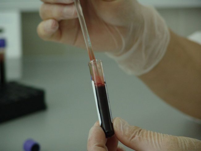 hemofobia (Kopírovať) hemofobia
